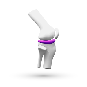 Логотип Боль. Остеоартрит